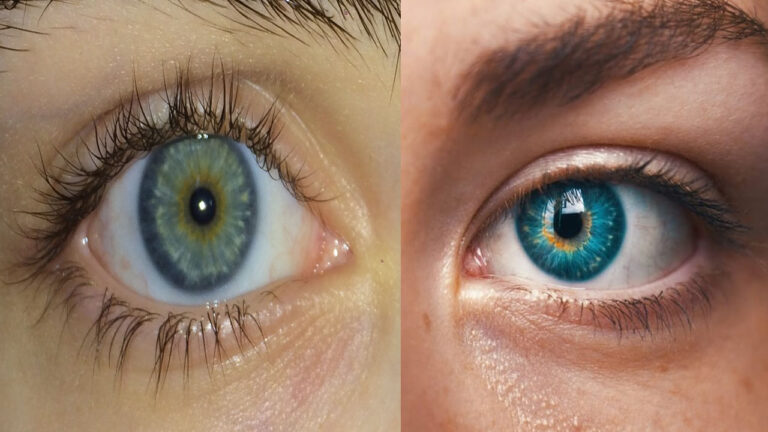 The Hidden Central Heterochromia Spiritual Meaning Revealed You Won T Believe What It Signifies