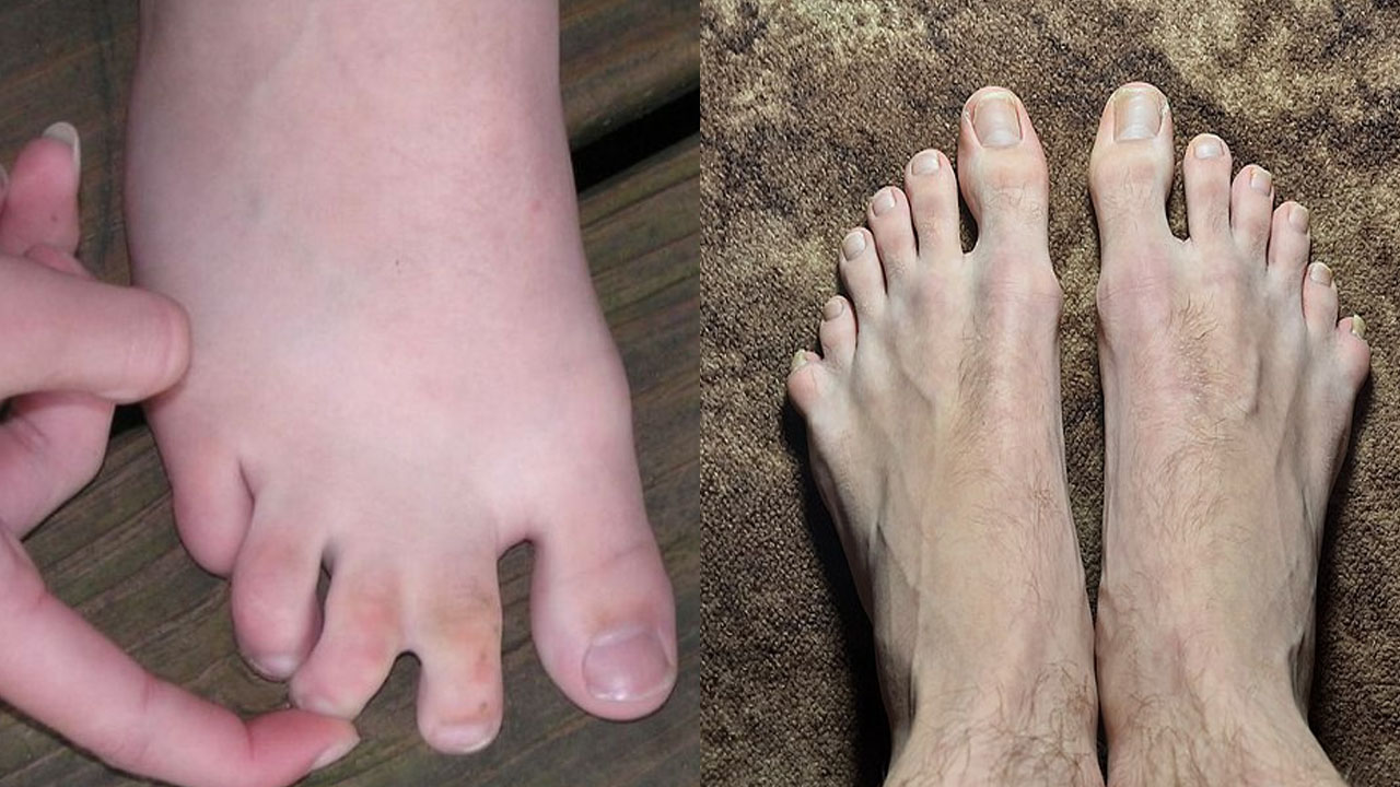 Webbed toes spiritual meaning Spiritual Insights You Need to Know!